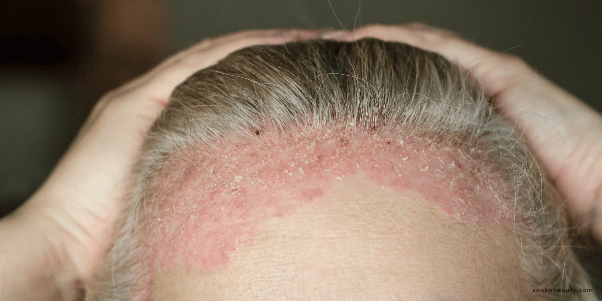 5 Signs Your Skin Is Asking for a Reset