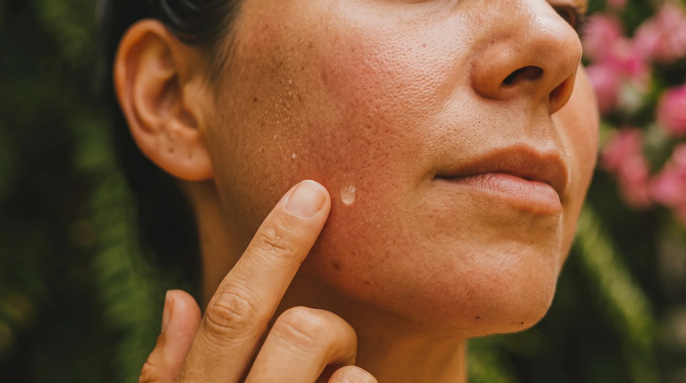Close-up of natural skin texture showing the skin barrier under soft lighting.