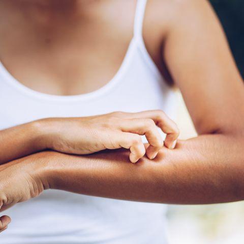 The Truth About Your Rash [Contact Dermatitis] - Sanbe Beauty, LLC