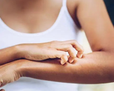 The Truth About Your Rash [Contact Dermatitis] - Sanbe Beauty, LLC