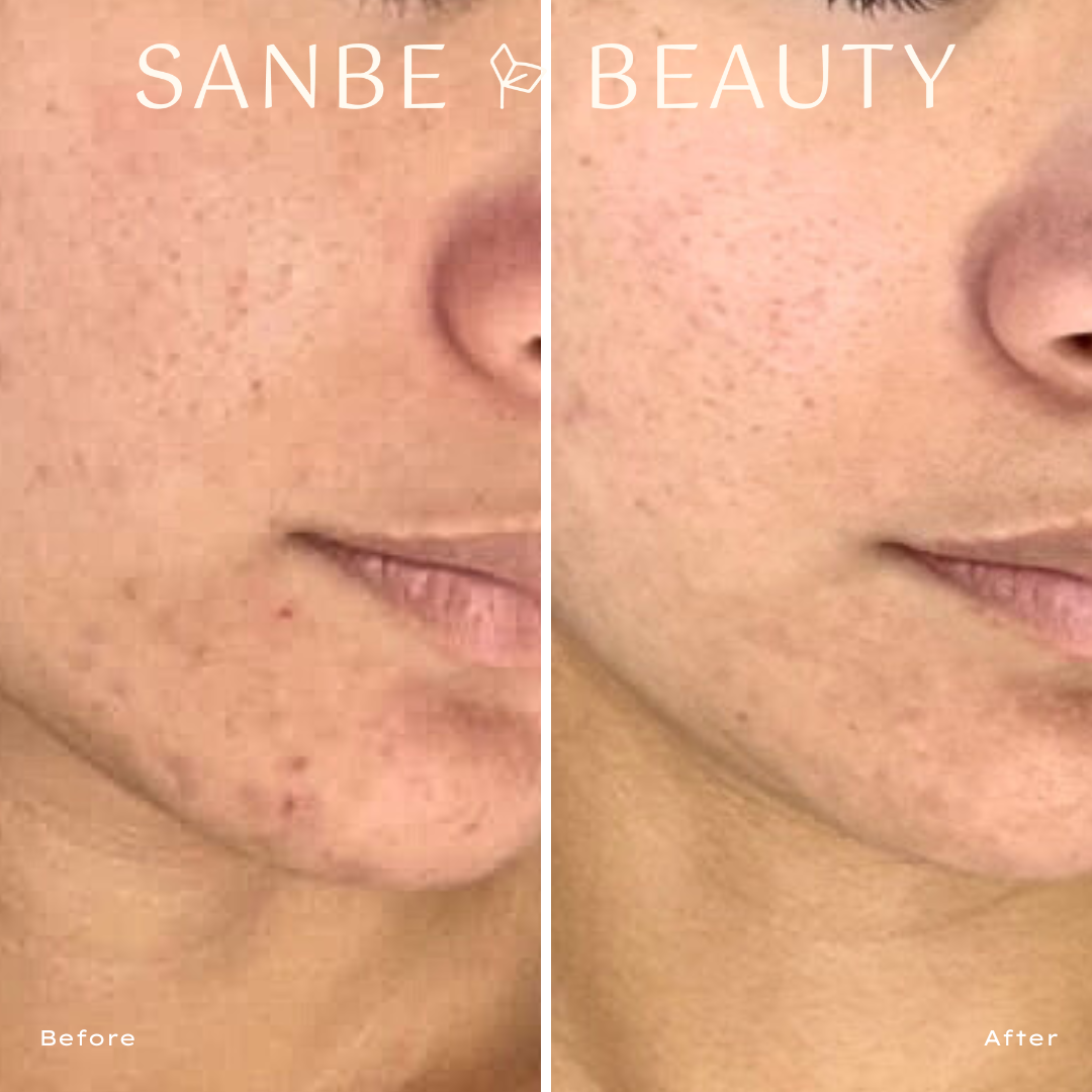 Glow Within THDA 20% Vitamin C Serum