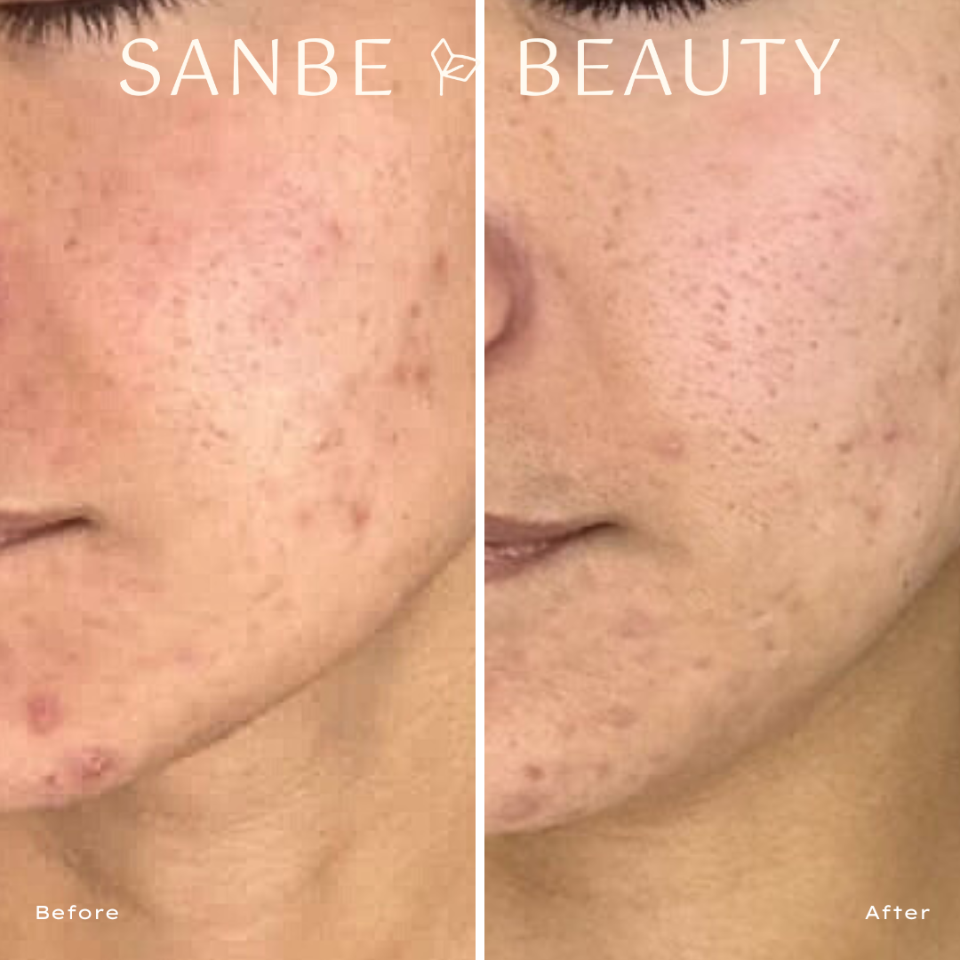 Glow Within THDA 20% Vitamin C Serum