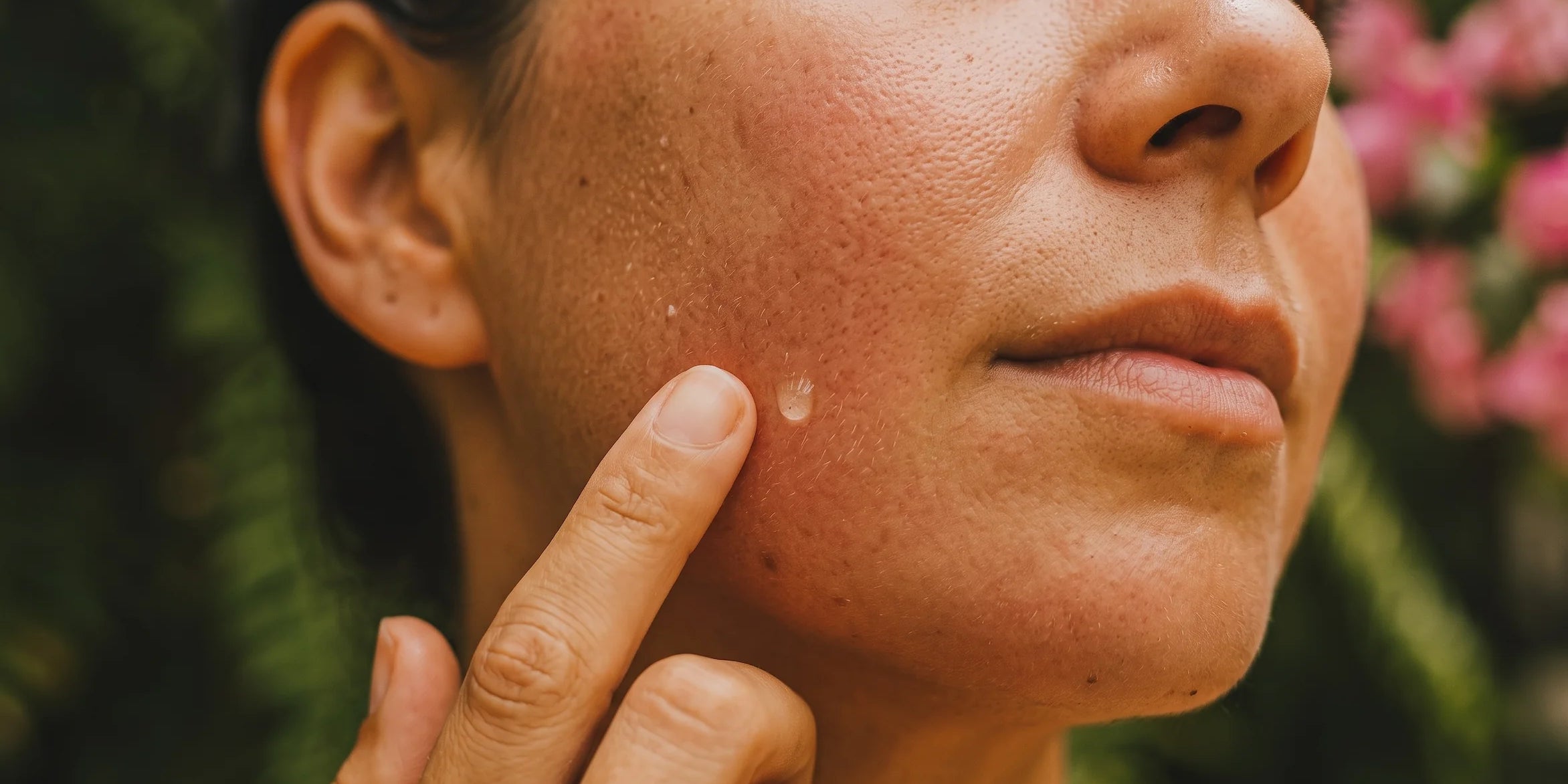 SEOon_Stress_and_skin_Featured_image___Comp.webp