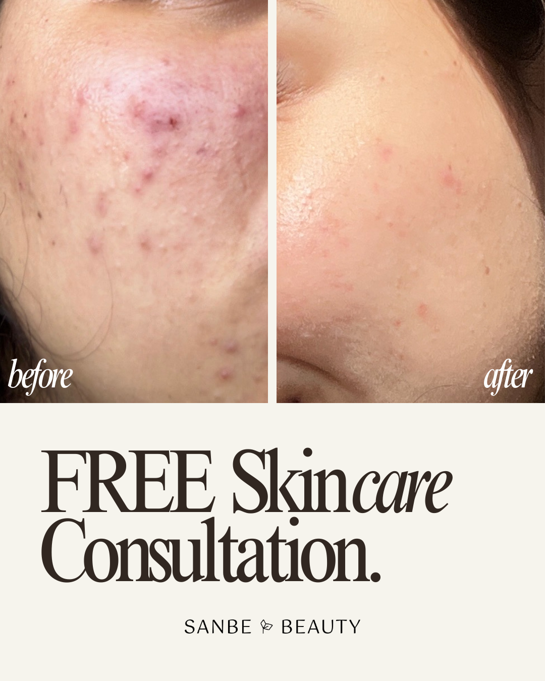Skincare_consultation_before_after.png